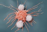 Erkeklerde ve kadınlarda en sık görülen kanser türleri açıklandı